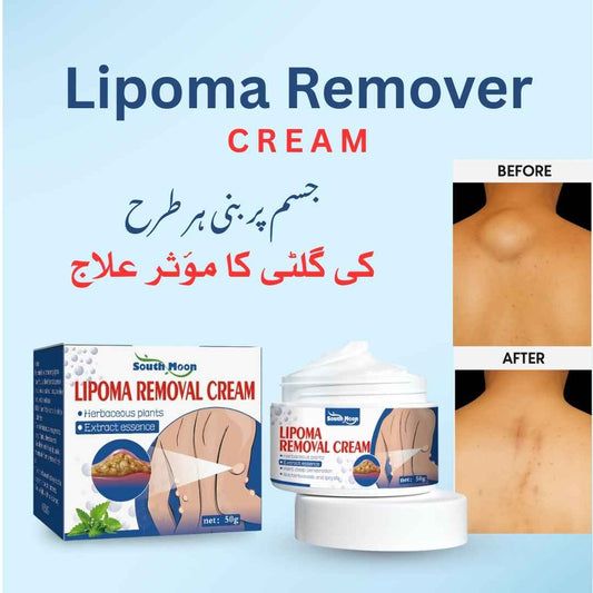 Lipoma Removal Cream | Ramzan Sale
